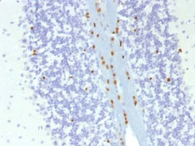 Immunohistochemistry (Formalin/PFA-fixed paraffin-embedded sections) - Anti-SOX10 antibody [SOX10/1074] (AB216020)