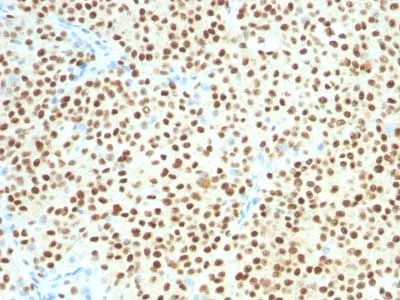 Immunohistochemistry (Formalin/PFA-fixed paraffin-embedded sections) - Anti-SOX10 antibody [SOX10/1074] (AB216020)