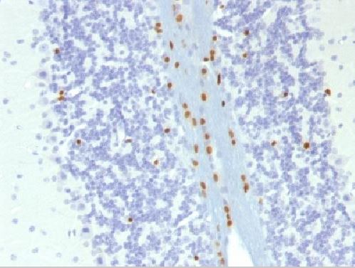 Immunohistochemistry (Formalin/PFA-fixed paraffin-embedded sections) - Anti-SOX10 antibody [SOX10/1074] - BSA and Azide free (AB212845), expandable thumbnail