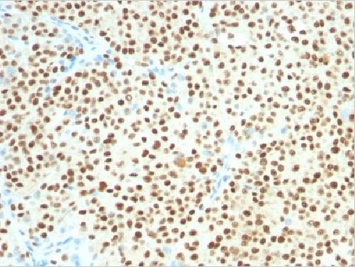 Immunohistochemistry (Formalin/PFA-fixed paraffin-embedded sections) - Anti-SOX10 antibody [SOX10/1074] - BSA and Azide free (AB212845), expandable thumbnail