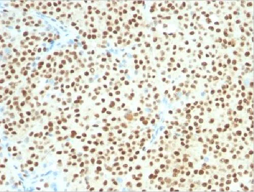 Immunohistochemistry (Formalin/PFA-fixed paraffin-embedded sections) - Anti-SOX10 antibody [SOX10/1074] - BSA and Azide free (AB212845)