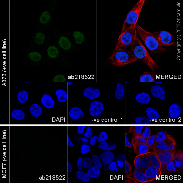 Immunocytochemistry/ Immunofluorescence - Anti-SOX10 antibody [SOX10/991] (AB218522), expandable thumbnail