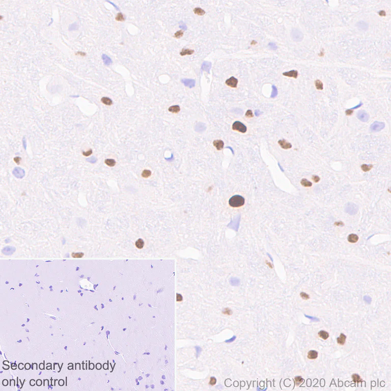 Immunohistochemistry (Formalin/PFA-fixed paraffin-embedded sections) - Anti-SOX10 antibody [SOX10/991] (AB218522)