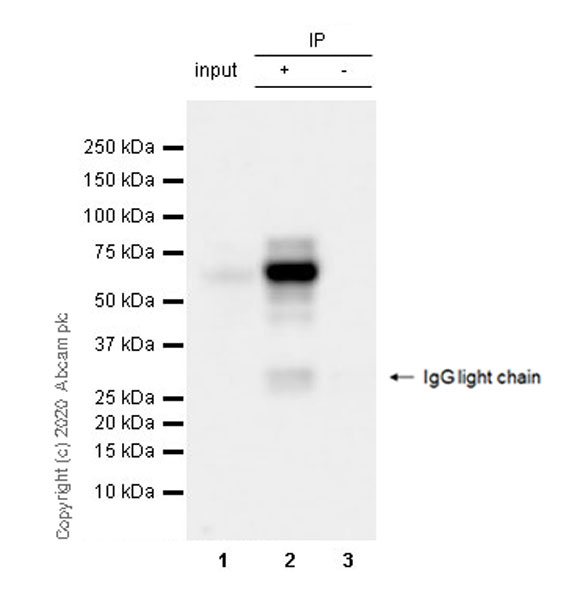 Immunoprecipitation - Anti-SOX10 antibody [SOX10/991] (AB218522), expandable thumbnail