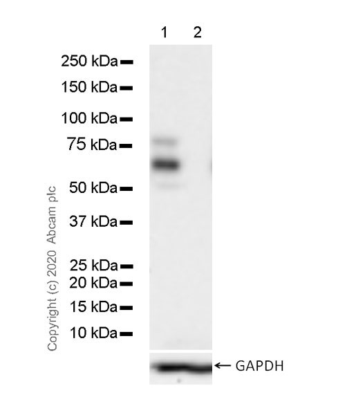 Western blot - Anti-SOX10 antibody [SOX10/991] (ab218522), expandable thumbnail