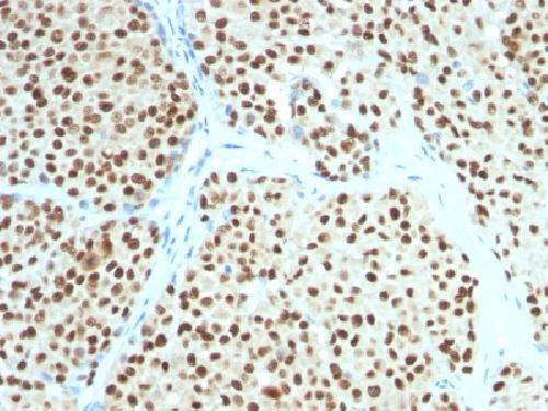 Immunohistochemistry (Formalin/PFA-fixed paraffin-embedded sections) - Anti-SOX10 antibody [SOX10/991] - BSA and Azide free (AB212843)