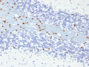 Immunohistochemistry (Formalin/PFA-fixed paraffin-embedded sections) - Anti-SOX10 antibody [SOX10/991] - BSA and Azide free (AB212843), expandable thumbnail