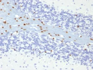 Immunohistochemistry (Formalin/PFA-fixed paraffin-embedded sections) - Anti-SOX10 antibody [SOX10/991] - BSA and Azide free (AB212843)