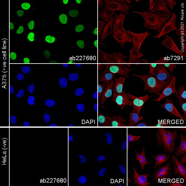 Immunocytochemistry/ Immunofluorescence - Anti-SOX10 antibody [SP267] (AB227680)