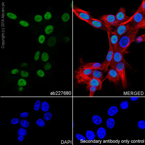 Immunocytochemistry/ Immunofluorescence - Anti-SOX10 antibody [SP267] (AB227680)