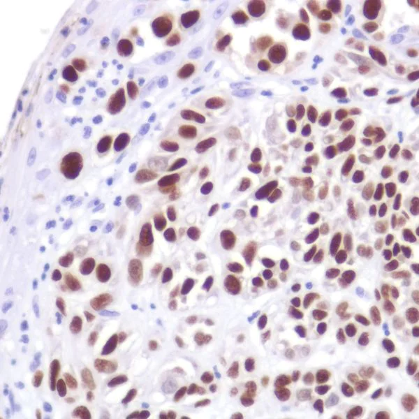 Immunohistochemistry (Formalin/PFA-fixed paraffin-embedded sections) - Anti-SOX10 antibody [SP267] (AB227680)