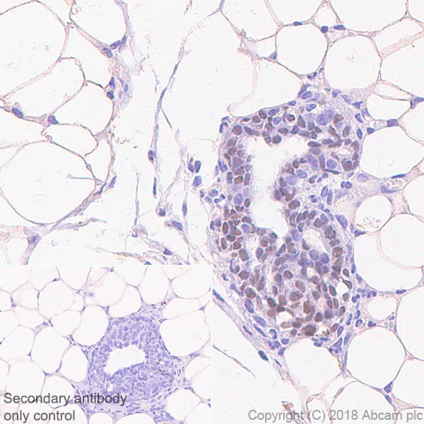 Immunohistochemistry (Formalin/PFA-fixed paraffin-embedded sections) - Anti-SOX10 antibody [SP267] (AB227680)