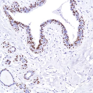 Immunohistochemistry (Formalin/PFA-fixed paraffin-embedded sections) - Anti-SOX10 antibody [SP275] (AB227684)