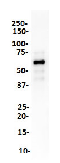 Western blot - Anti-SOX10 antibody [SP275] (AB227684), expandable thumbnail
