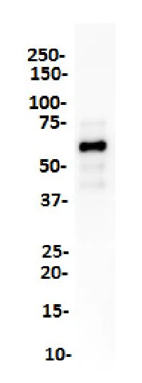 Western blot - Anti-SOX10 antibody [SP275] (AB227684)