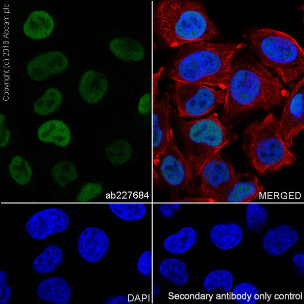 Immunocytochemistry/ Immunofluorescence - Anti-SOX10 antibody [SP275] - BSA and Azide free (AB239751)