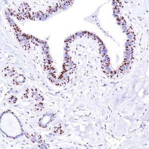 Immunohistochemistry (Formalin/PFA-fixed paraffin-embedded sections) - Anti-SOX10 antibody [SP275] - BSA and Azide free (ab239751), expandable thumbnail
