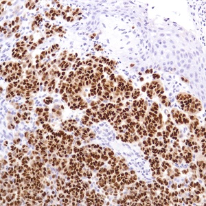 Immunohistochemistry (Formalin/PFA-fixed paraffin-embedded sections) - Anti-SOX10 antibody [SP275] - BSA and Azide free (AB239751), expandable thumbnail