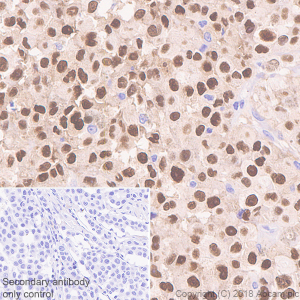 Immunohistochemistry (Formalin/PFA-fixed paraffin-embedded sections) - Anti-SOX10 antibody [SP275] - BSA and Azide free (AB239751), expandable thumbnail