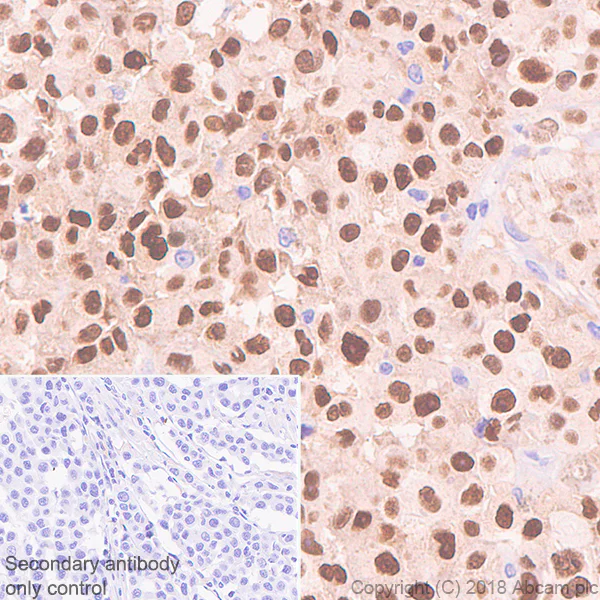 Immunohistochemistry (Formalin/PFA-fixed paraffin-embedded sections) - Anti-SOX10 antibody [SP275] - BSA and Azide free (AB239751)