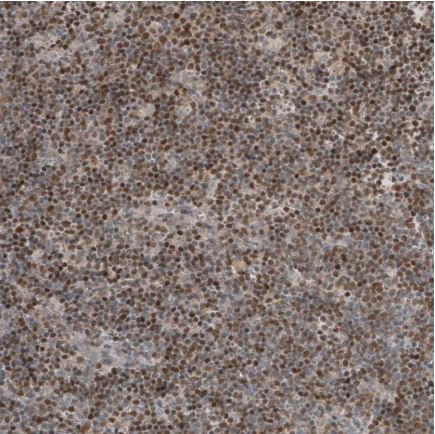 Immunohistochemistry (Formalin/PFA-fixed paraffin-embedded sections) - Anti-SOX11 antibody (AB211357), expandable thumbnail