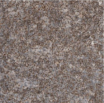 Immunohistochemistry (Formalin/PFA-fixed paraffin-embedded sections) - Anti-SOX11 antibody (AB211357)