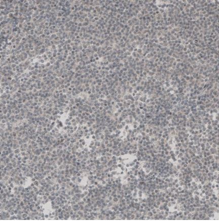 Immunohistochemistry (Formalin/PFA-fixed paraffin-embedded sections) - Anti-SOX11 antibody (AB211357), expandable thumbnail