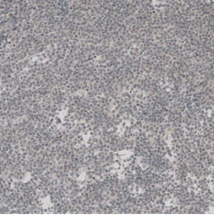 Immunohistochemistry (Formalin/PFA-fixed paraffin-embedded sections) - Anti-SOX11 antibody (AB211357)