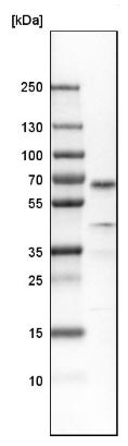 Western blot - Anti-SOX11 antibody (AB211357), expandable thumbnail