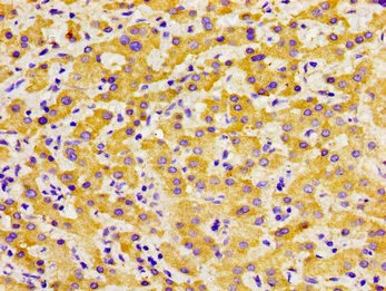 Immunohistochemistry (Formalin/PFA-fixed paraffin-embedded sections) - Anti-SOX11 antibody (AB234996)