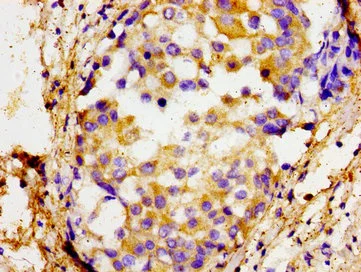 Immunohistochemistry (Formalin/PFA-fixed paraffin-embedded sections) - Anti-SOX11 antibody (AB234996)