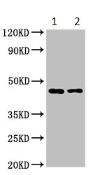 Western blot - Anti-SOX11 antibody (AB234996)