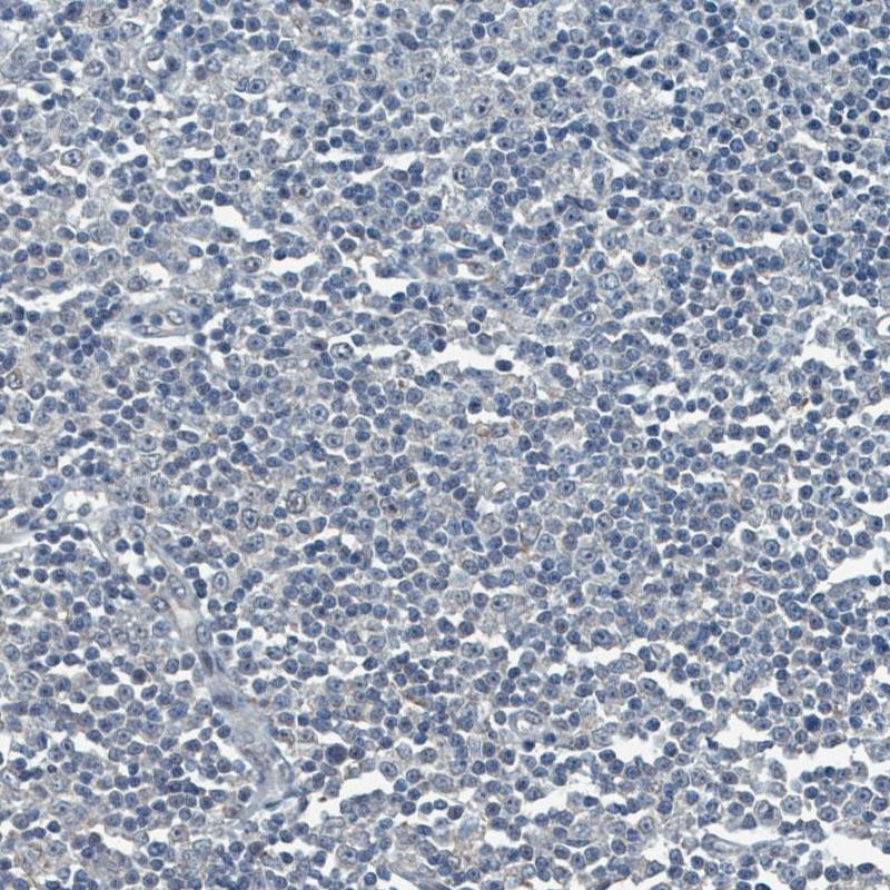 Immunohistochemistry (Formalin/PFA-fixed paraffin-embedded sections) - Anti-SOX11 antibody [CL0142] (AB154138)