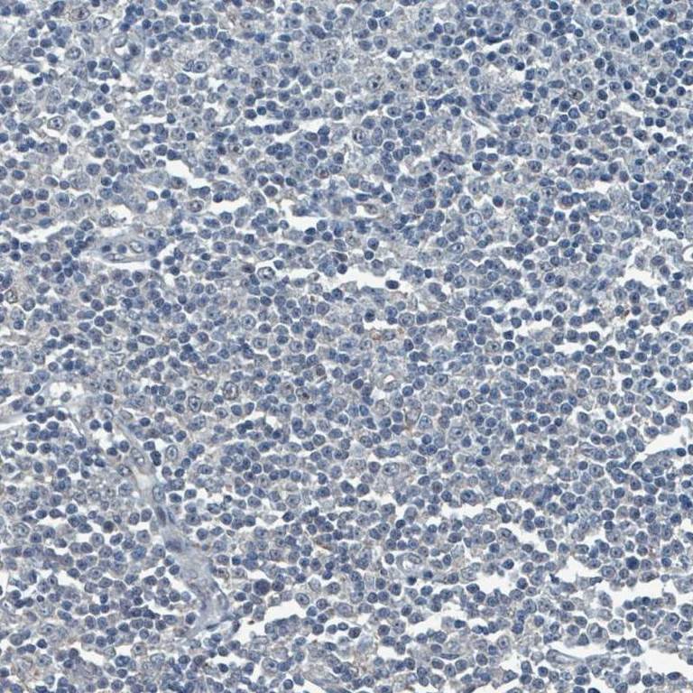 Immunohistochemistry (Formalin/PFA-fixed paraffin-embedded sections) - Anti-SOX11 antibody [CL0142] (AB154138)