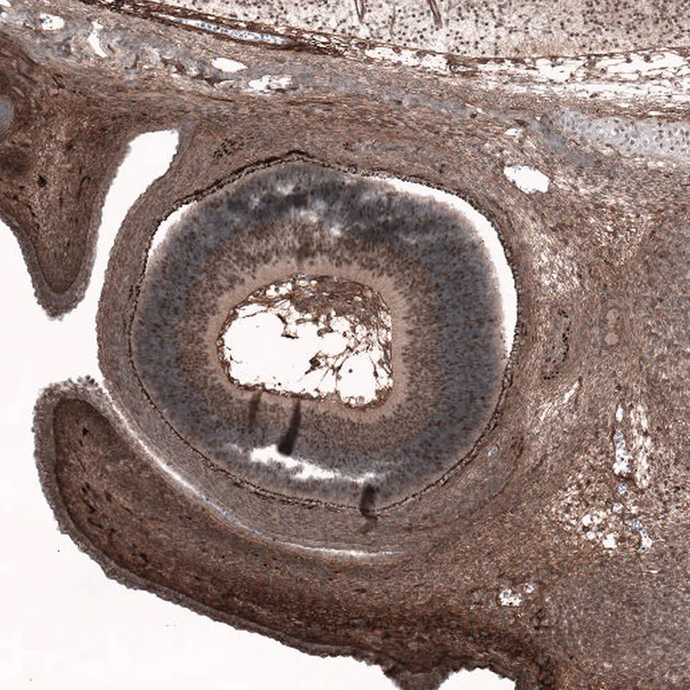 Immunohistochemistry (Formalin/PFA-fixed paraffin-embedded sections) - Anti-SOX11 antibody [CL0142] (AB154138)