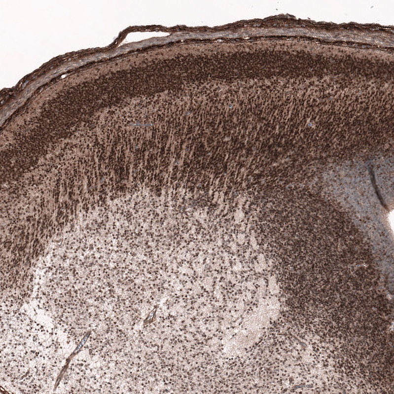 Immunohistochemistry (Formalin/PFA-fixed paraffin-embedded sections) - Anti-SOX11 antibody [CL0142] (AB154138)