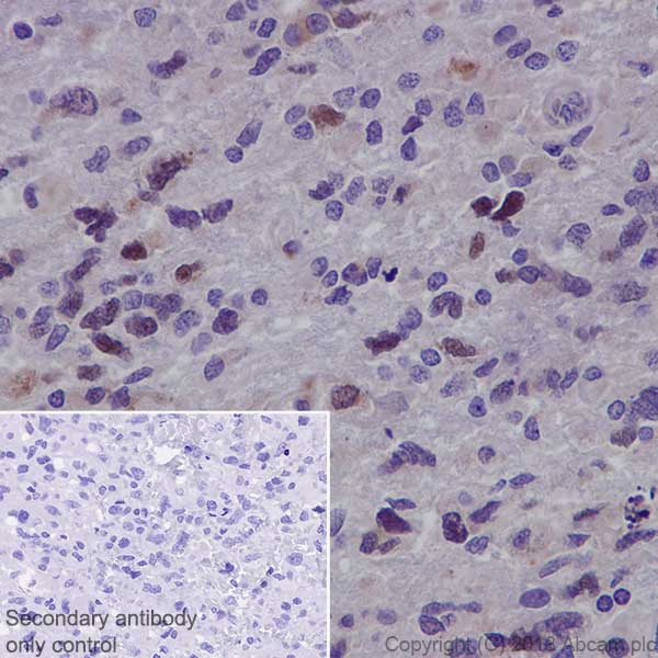 Immunohistochemistry (Formalin/PFA-fixed paraffin-embedded sections) - Anti-SOX11 antibody [EPR20457] (AB229185)
