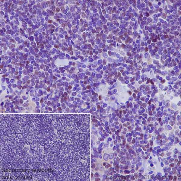 Immunohistochemistry (Formalin/PFA-fixed paraffin-embedded sections) - Anti-SOX11 antibody [EPR20457] - BSA and Azide free (AB239787)