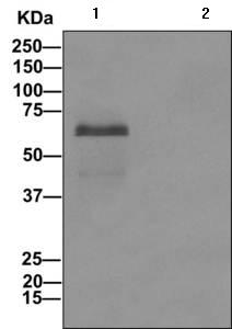 Immunoprecipitation - Anti-SOX11 antibody [EPR8191(2)] - BSA and Azide free (AB249588), expandable thumbnail
