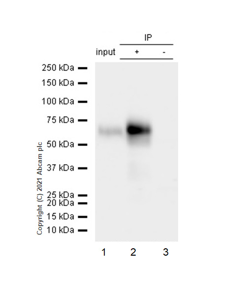 Immunoprecipitation - Anti-SOX11 antibody [EPR8192] (AB134107), expandable thumbnail