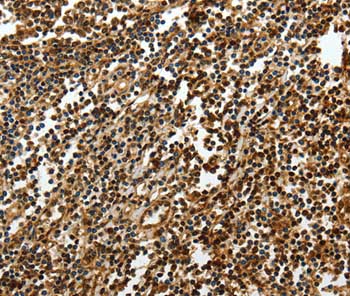 Immunohistochemistry (Formalin/PFA-fixed paraffin-embedded sections) - Anti-SOX13 antibody (AB198921)