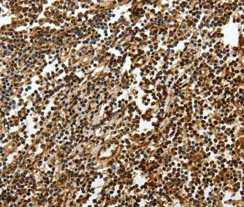 Immunohistochemistry (Formalin/PFA-fixed paraffin-embedded sections) - Anti-SOX13 antibody (AB198921)