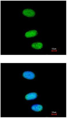 Immunocytochemistry/ Immunofluorescence - Anti-SOX13 antibody (AB96776)