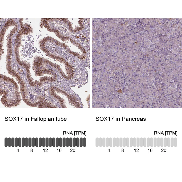 Immunohistochemistry (Formalin/PFA-fixed paraffin-embedded sections) - Anti-SOX17 Antibody (AB327269)