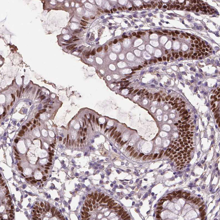 Immunohistochemistry (Formalin/PFA-fixed paraffin-embedded sections) - Anti-SOX17 Antibody (AB327269)