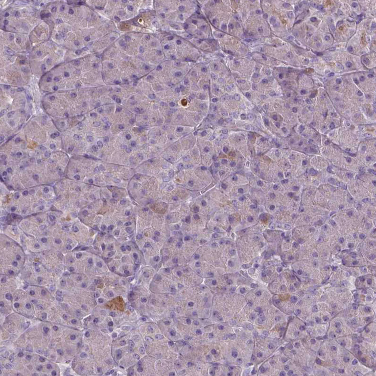 Immunohistochemistry (Formalin/PFA-fixed paraffin-embedded sections) - Anti-SOX17 Antibody (AB327269)