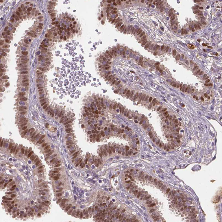 Immunohistochemistry (Formalin/PFA-fixed paraffin-embedded sections) - Anti-SOX17 Antibody (AB327269)