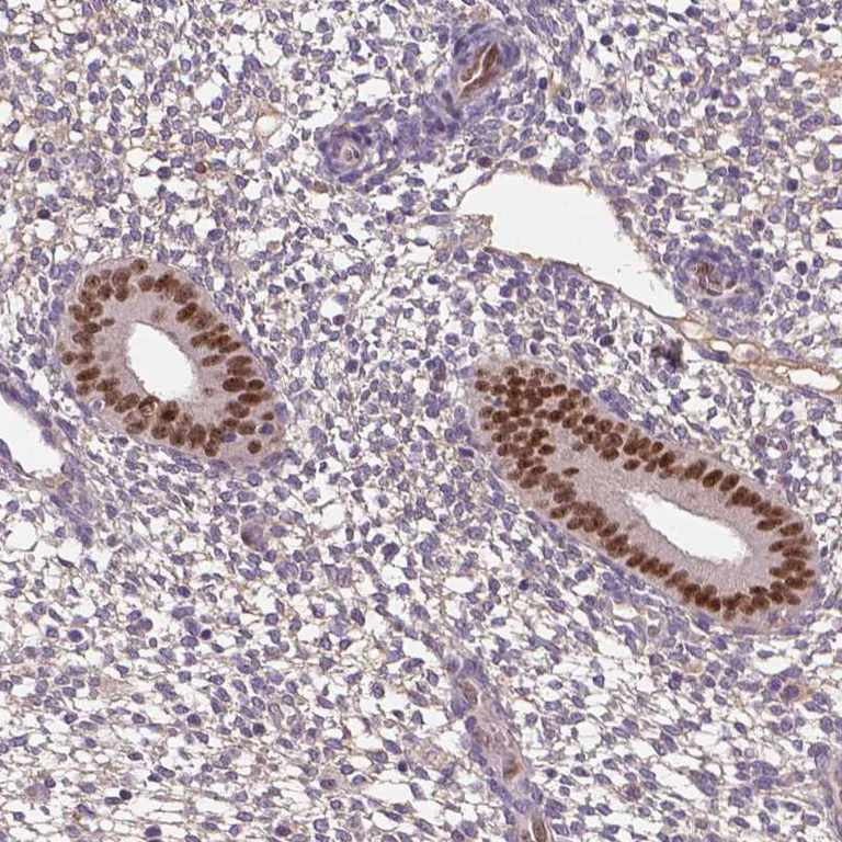 Immunohistochemistry (Formalin/PFA-fixed paraffin-embedded sections) - Anti-SOX17 Antibody (AB327269)