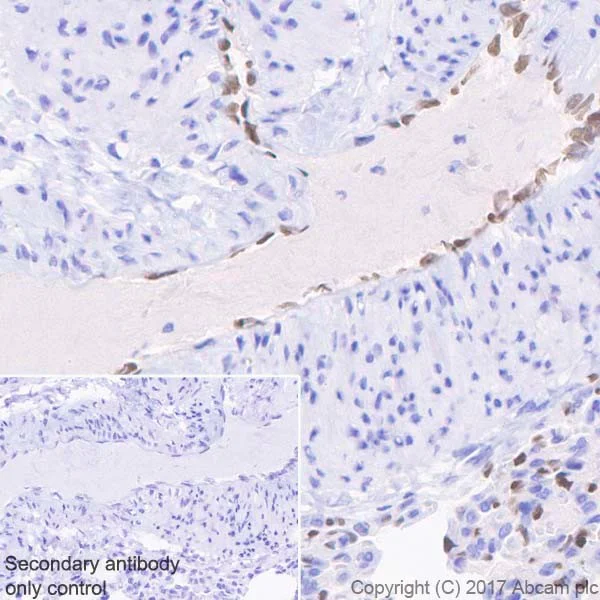 Immunohistochemistry (Formalin/PFA-fixed paraffin-embedded sections) - Anti-SOX17 antibody [EPR20684] (AB224637)