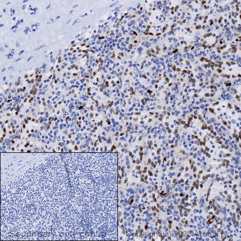 Immunohistochemistry (Formalin/PFA-fixed paraffin-embedded sections) - Anti-SOX17 antibody [EPR20684] (AB224637)